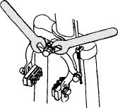 Ausrichtung des Bremskrpers